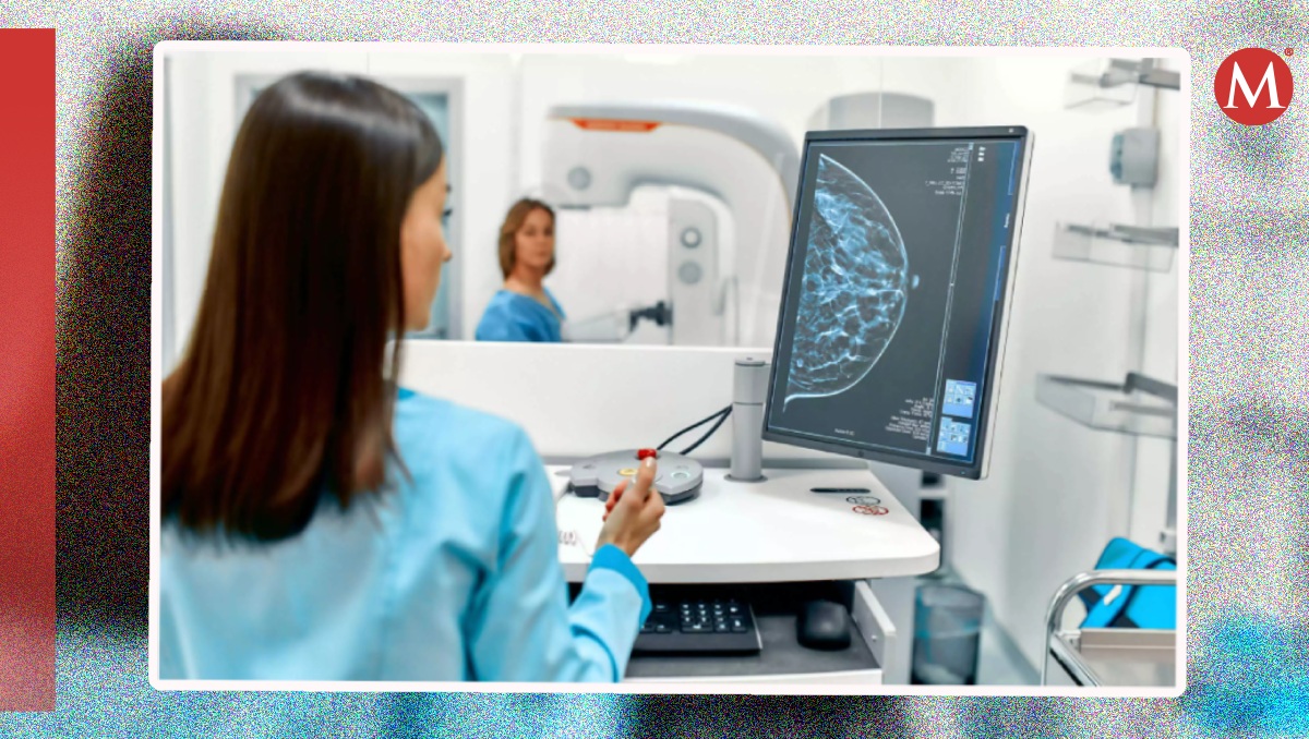 La UNAM indica que en México fallecen 12 mujeres al día por cáncer de mama | Especial