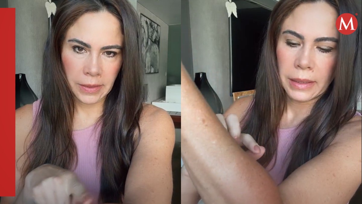 Paola Rojas pide ayuda tras sufrir fuerte ACCIDENTE en el brazo