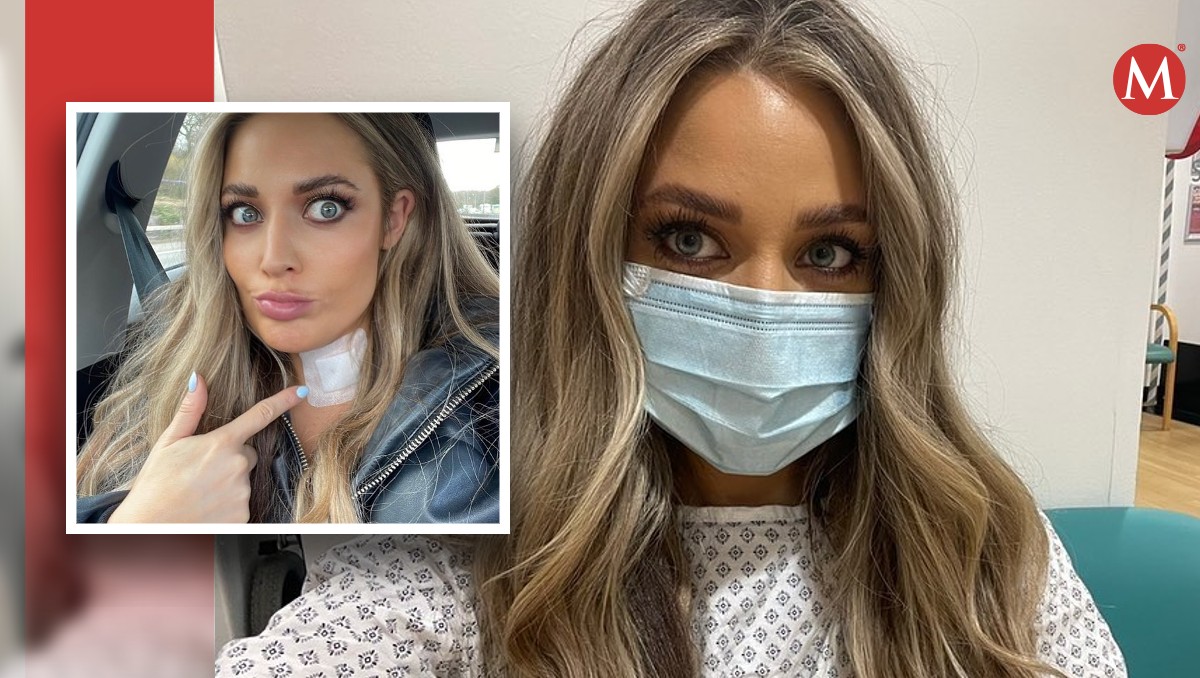 Abi Phillips reveló a sus fans cómo fue que un médico le diagnosticó un resfriado, pero era cáncer de tiroides. | Instagram @abiphillipsuk