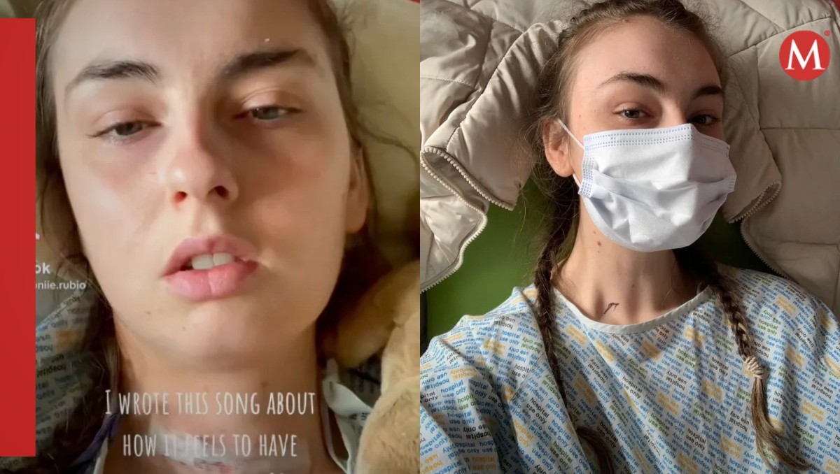 Joven pensó que era alérgica al maquillaje y resultó que tenía cáncer