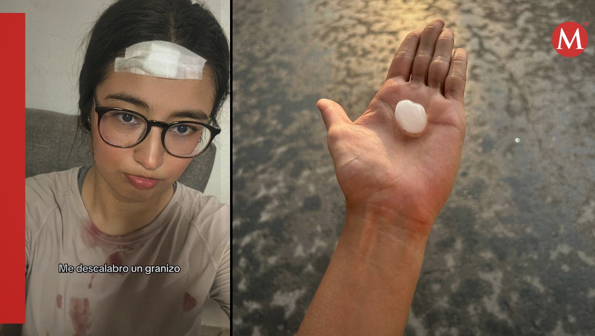 Joven es descalabrada por un enorme granizo en Apodaca, Nuevo León