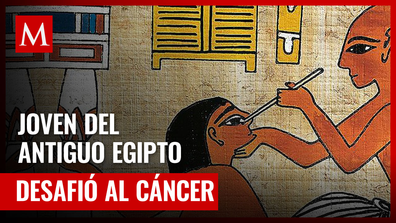 El primer caso de cirugía de cáncer en un hombre de 30 años en el Antiguo Egipto