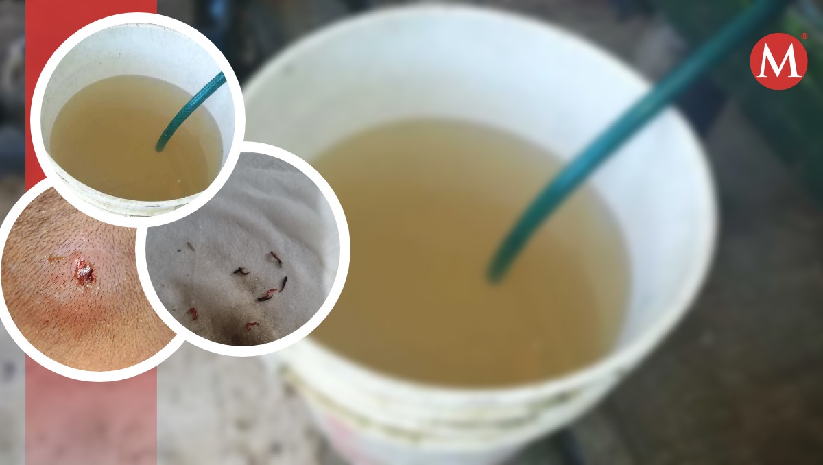 Agua sucia provoca padecimientos dermatológicos en sur de Tamaulipas