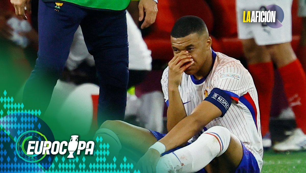 ¡Preocupación en Francia! Así luce la nariz de Mbappé tras chocar con rival (Reuters)