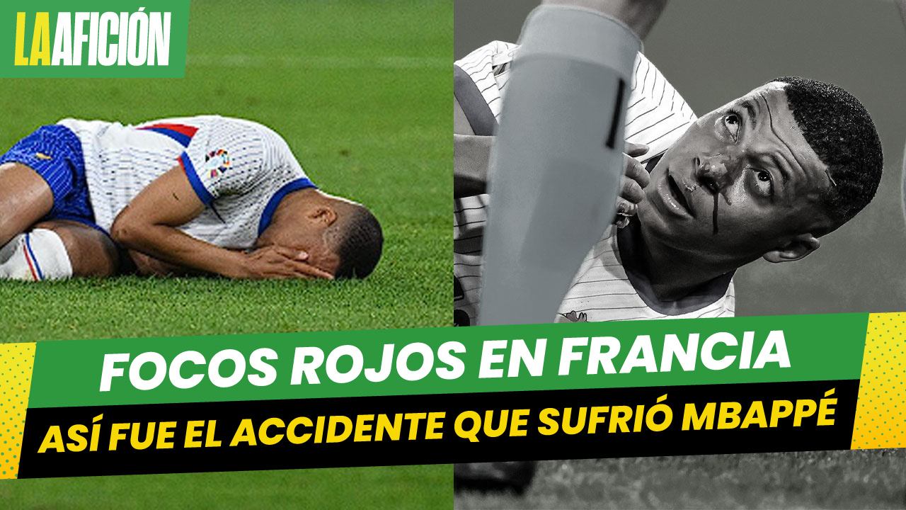 ¡Preocupación en Francia! Mbappé sufre terrible accidente durante la Eurocopa