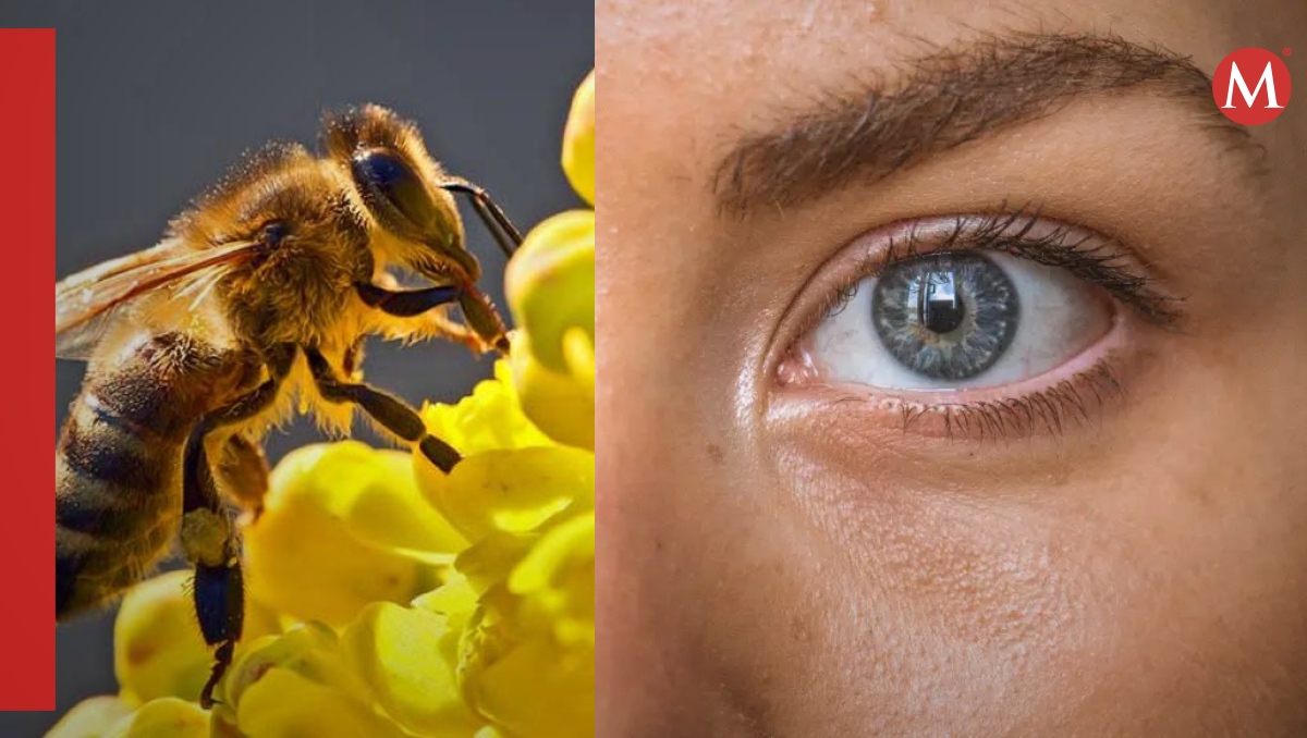 Una abeja picó a un hombre en el ojo y este casi pierde la vista