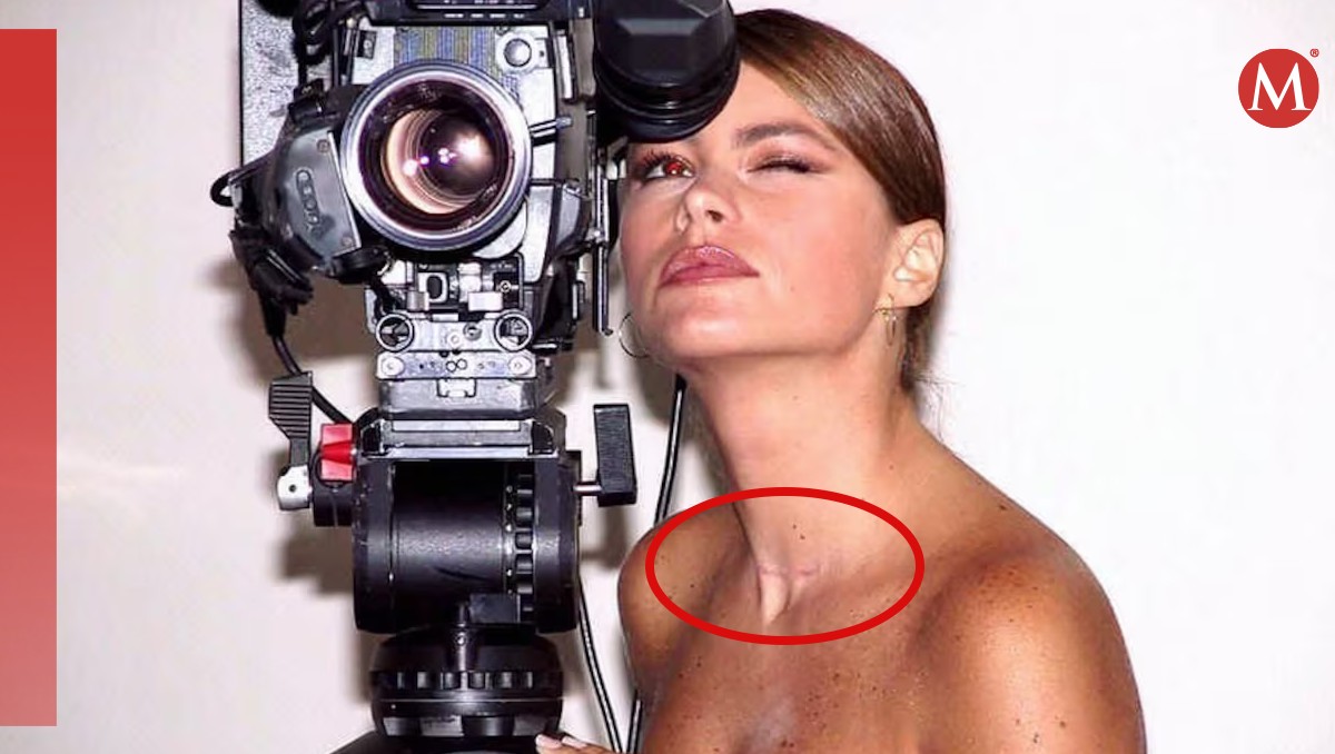 Sofia Vergara: Qué tipo de cáncer tuvo la actriz de Modern Family