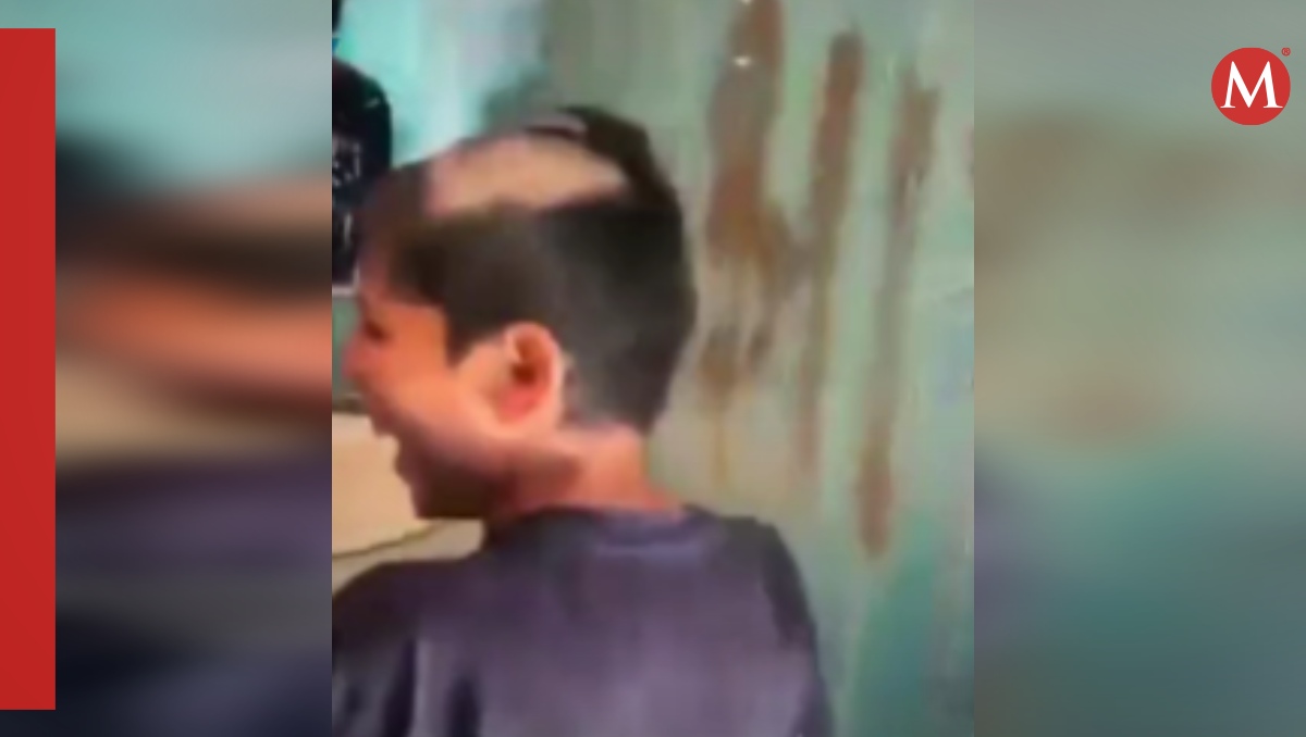 Niños quedan calvos al confundir crema para depilar con shampoo