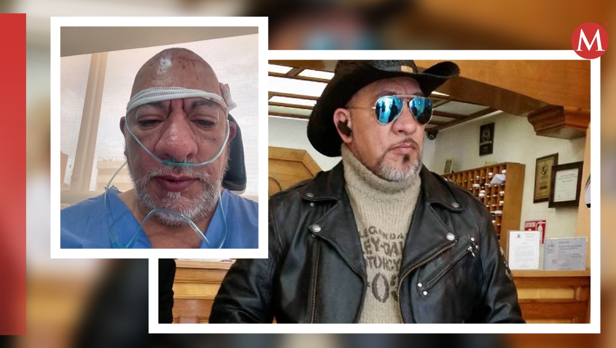 Carlos Trejo asusta con fotos en sus redes. | ESPECIAL