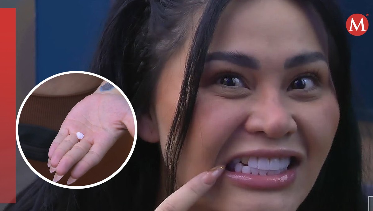 Gomita perdió una carilla en La Casa de los Famosos 2.