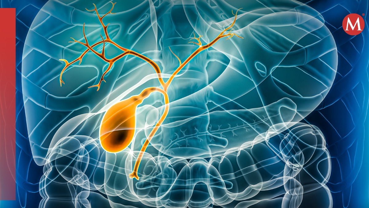 Cáncer de vías biliares