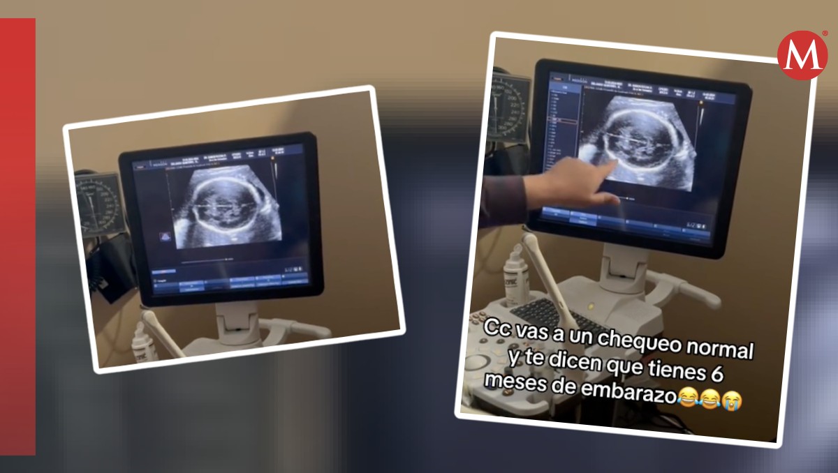 Mujer va al médico y se entera que lleva MESES embarazada