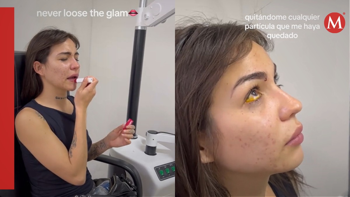 Influencer graba el momento en que una lámpara EXPLOTA en su cara