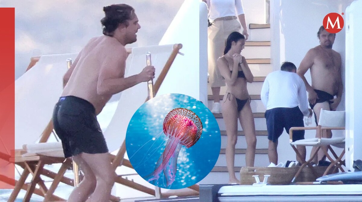 Leonardo DiCaprio es picado por una medusa en Italia.