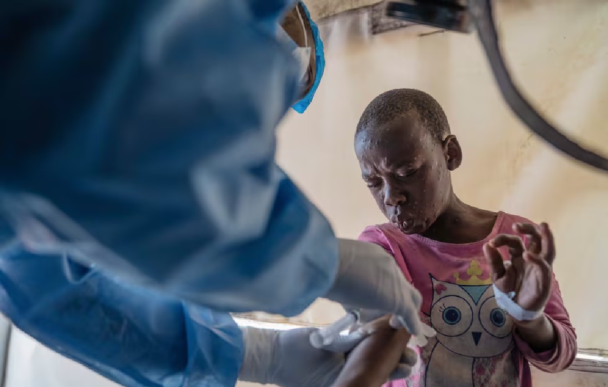 Trabajador de salud revisa a un paciente con viruela de mono en Munigi, RDC (AP)