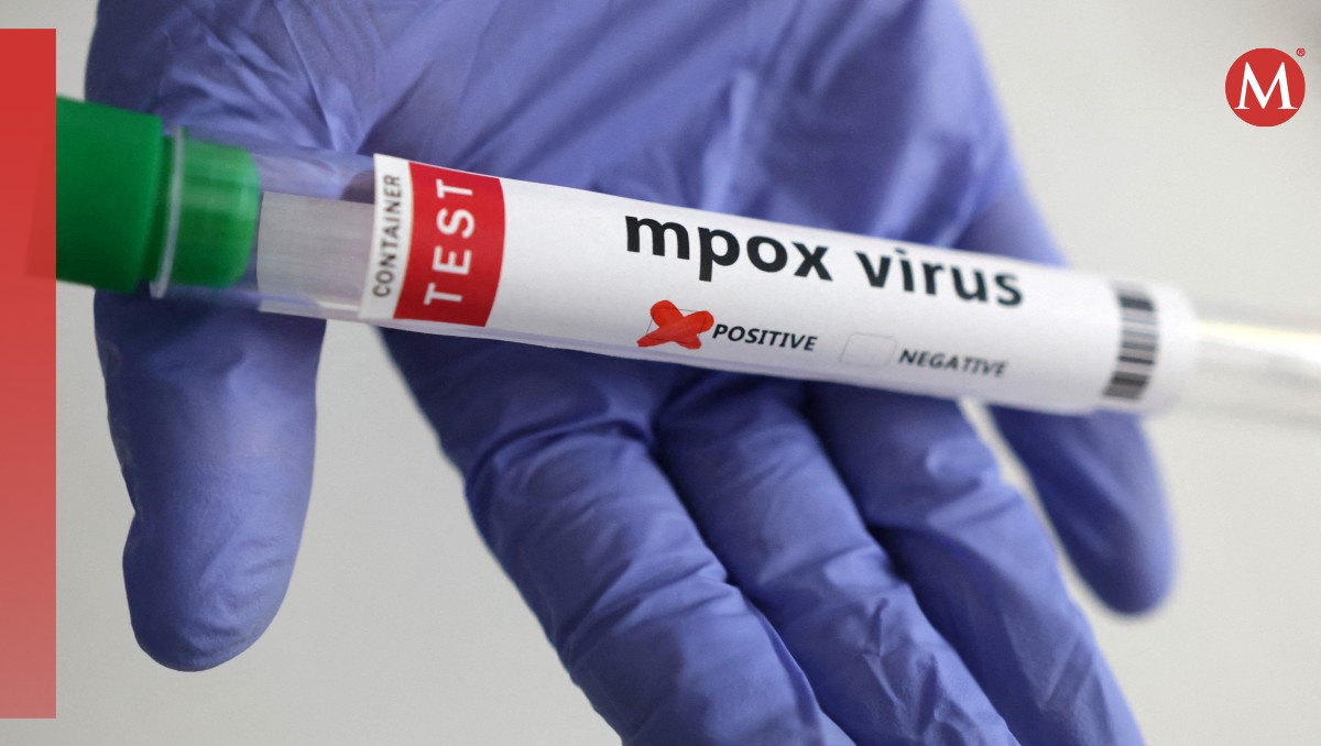 Todos los turistas deben someterse a una prueba del mpox. | Reuters