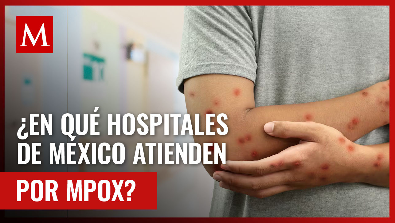 México acumula 55 contagios de Mpox; ¿es posible atender la enfermedad en cualquier hospital?
