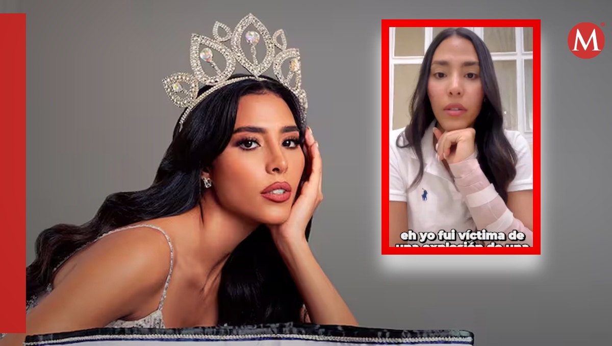 Debbie Aflalo, ex participante de Miss Universo, resultó con graves quemaduras | ESPECIAL