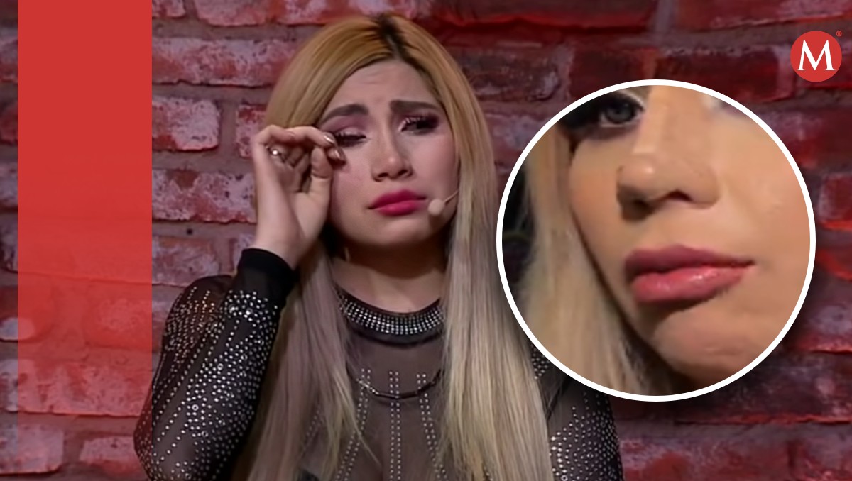 La Bebeshita es víctima de una mala cirugía en su nariz; así quedó. | Especial