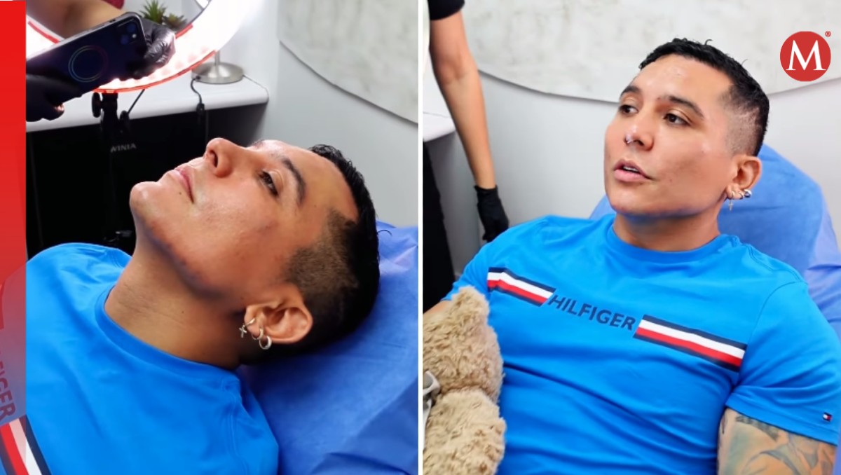 Edwin Luna revela que se injertó cabello; estos son sus arreglitos