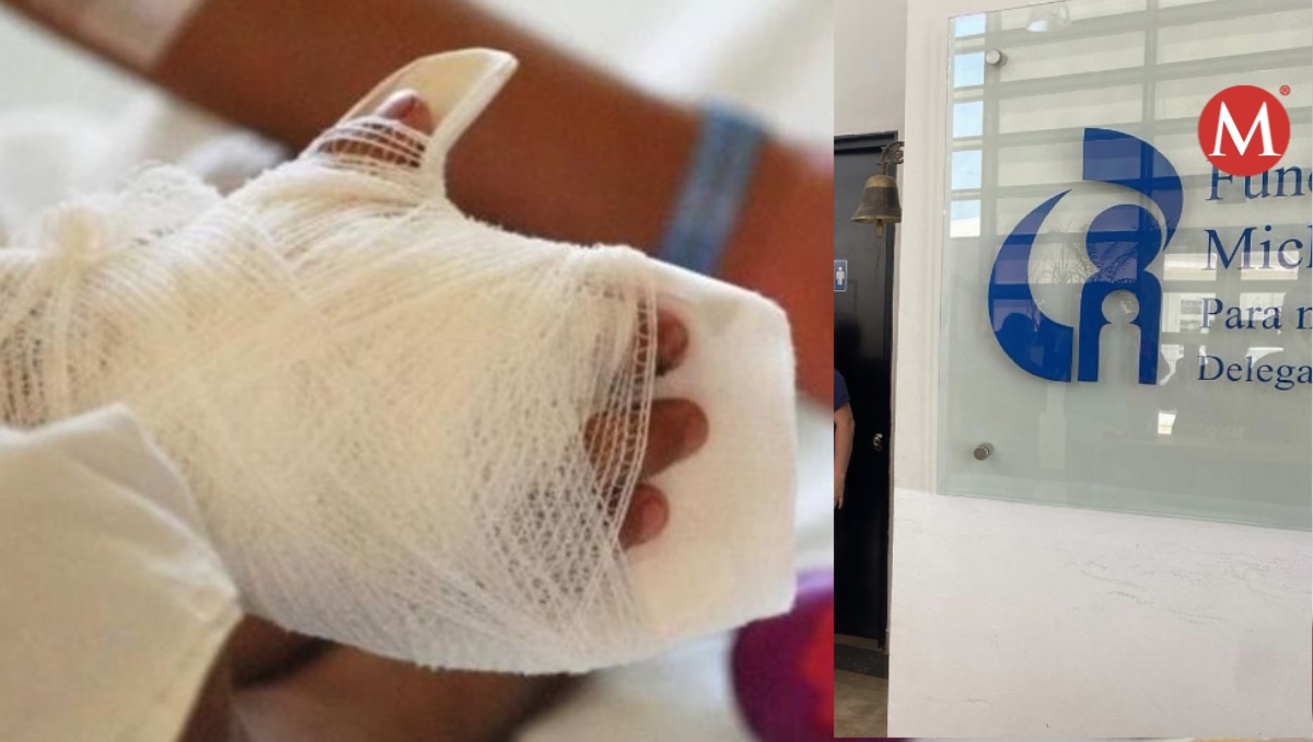 Niña sufre quemaduras al caer en olla de pozole en Tamaulipas.