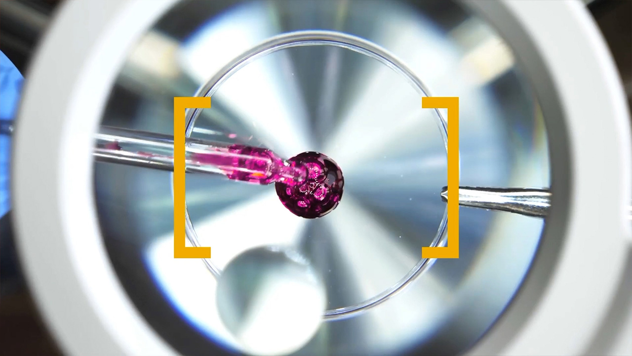 IA para la predicción de enfermedades, Galaxy Ring y ciberseguridad de Google | Milenio Tech