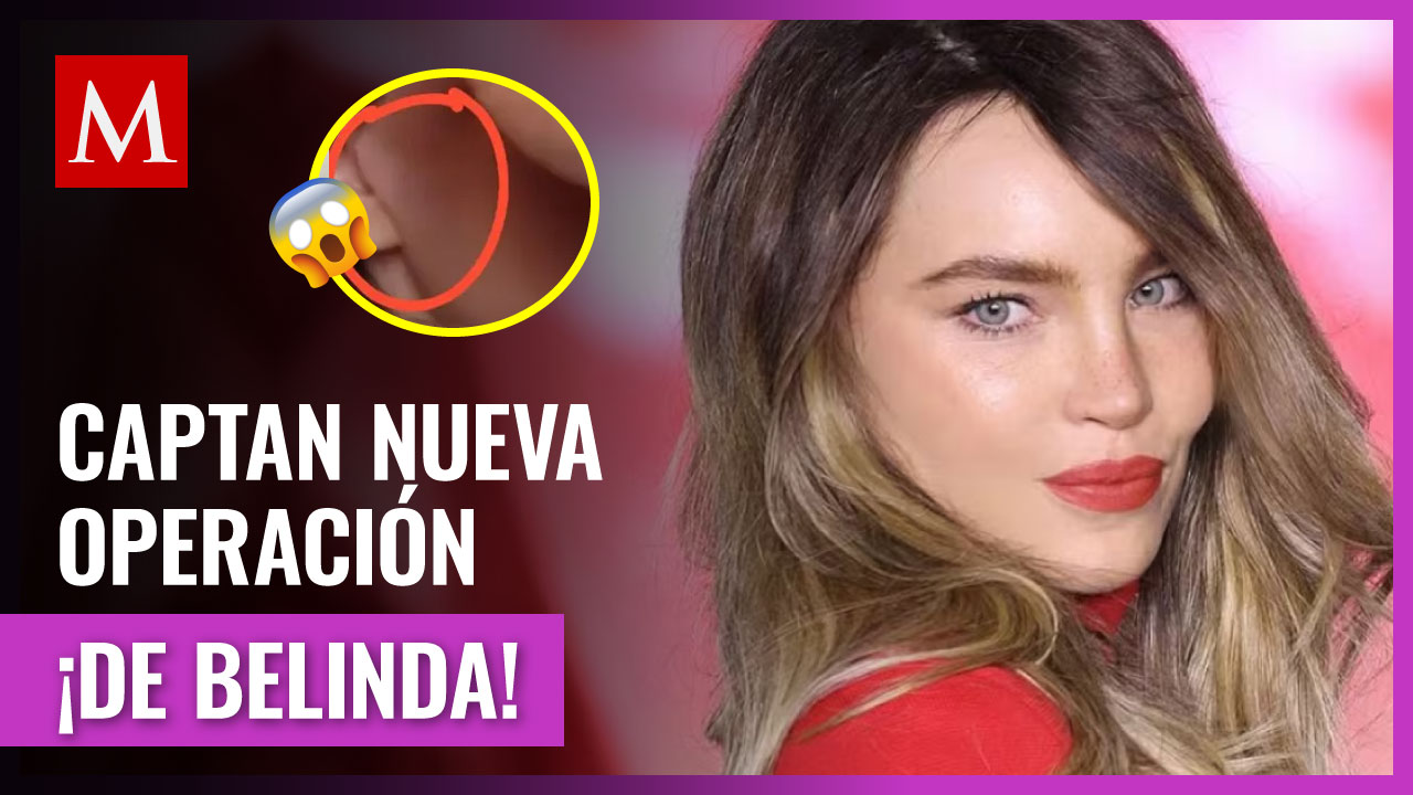 Belinda se habría sometido a una nueva cirugía plástica