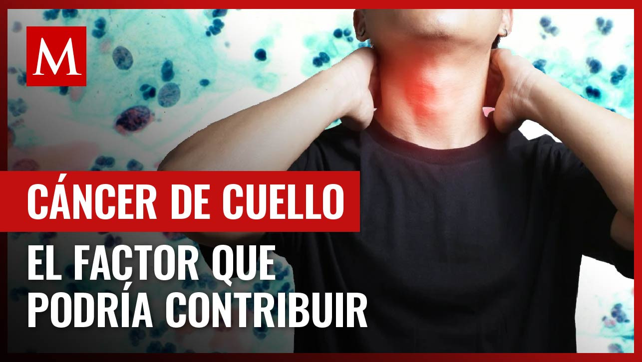 El riesgo de padecer cáncer de cabeza y cuello podría estar asociado a esto