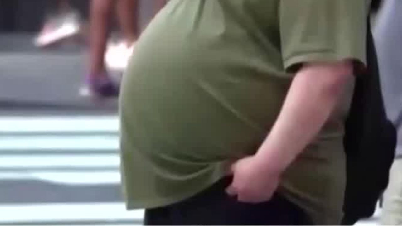 Obesidad, un problema creciente en México