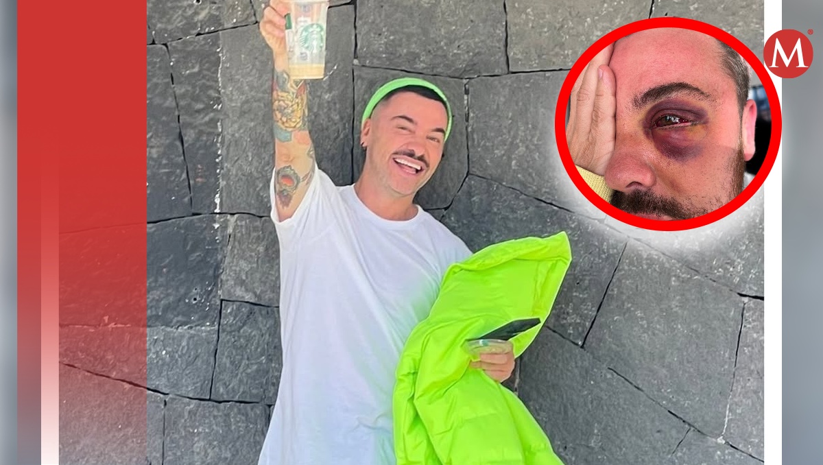 Shiky Clement recuerda en podcast 'Envinadas' cómo fue que perdió la vista en un ojo | ESPECIAL