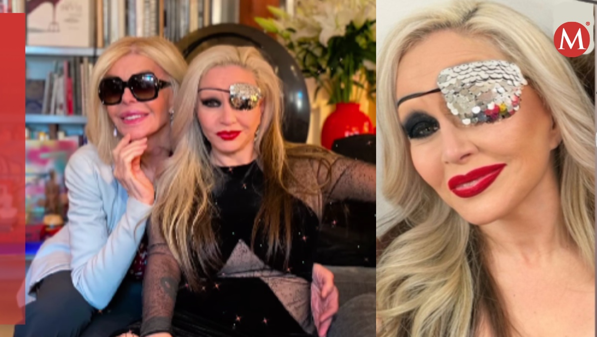 Cantante Alaska perdió la visión de su ojo | Especial