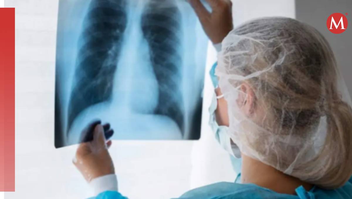 El cáncer de pulmón es una de las enfermedades más comunes de México