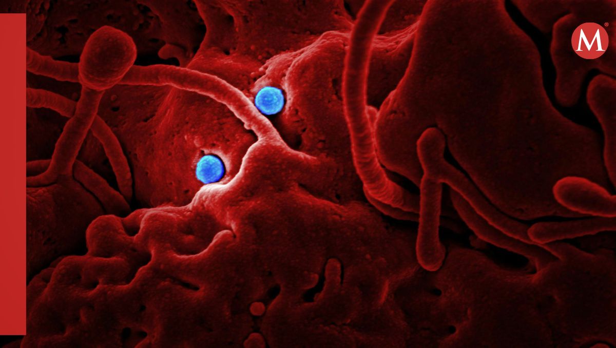 La bordetella pertussi es la bacteria responsable de la tos ferina | CDC