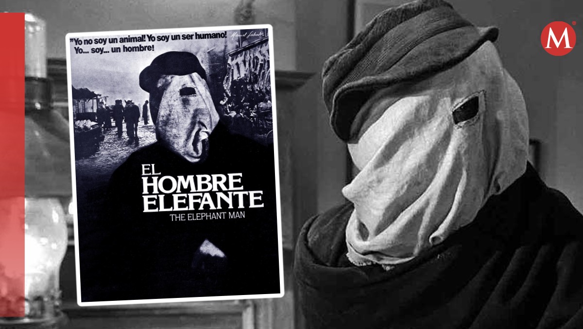 'El Hombre Elefante': De que tráta y donde ver la cinta de David Lynch | Prime Video