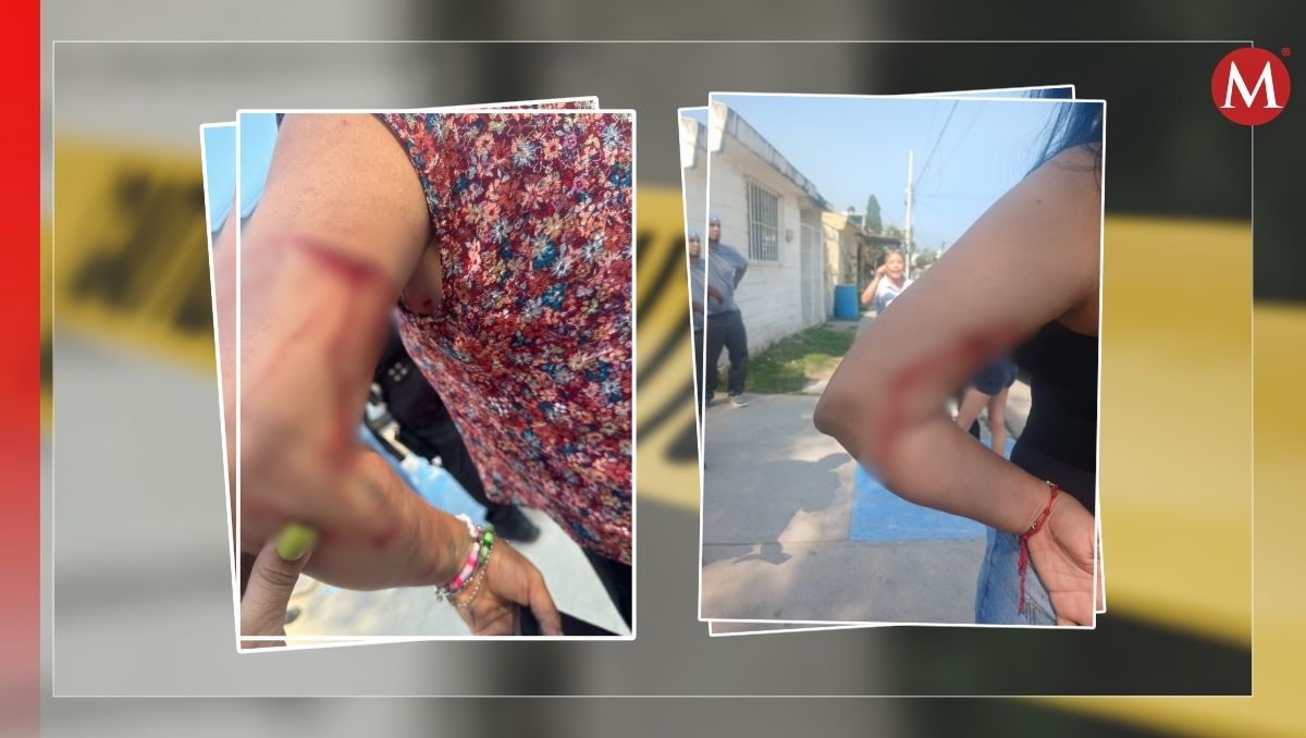 Las mujeres lesionadas fueron trasladadas al Hospital General Carlos Canseco. (Alberto Cano)