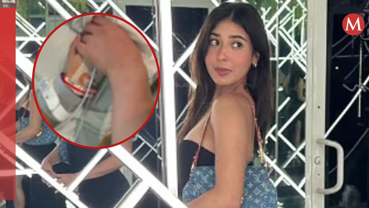 La joven Jazmín Garza incluso necesitó soporte viral para recuperarse | Especial