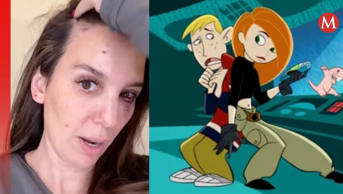 Actriz de Disney Channel, recibió un disparo en la cara | Especial
