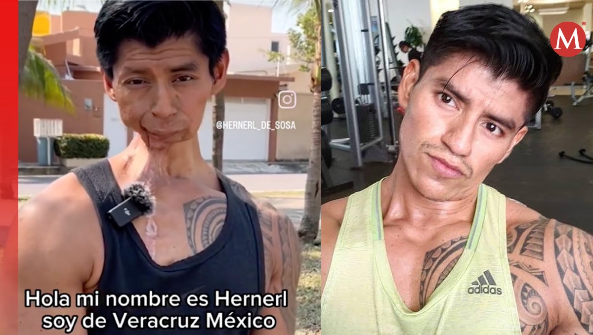 Deportista se vuelve viral por vencer al cáncer. | ESPECIAL