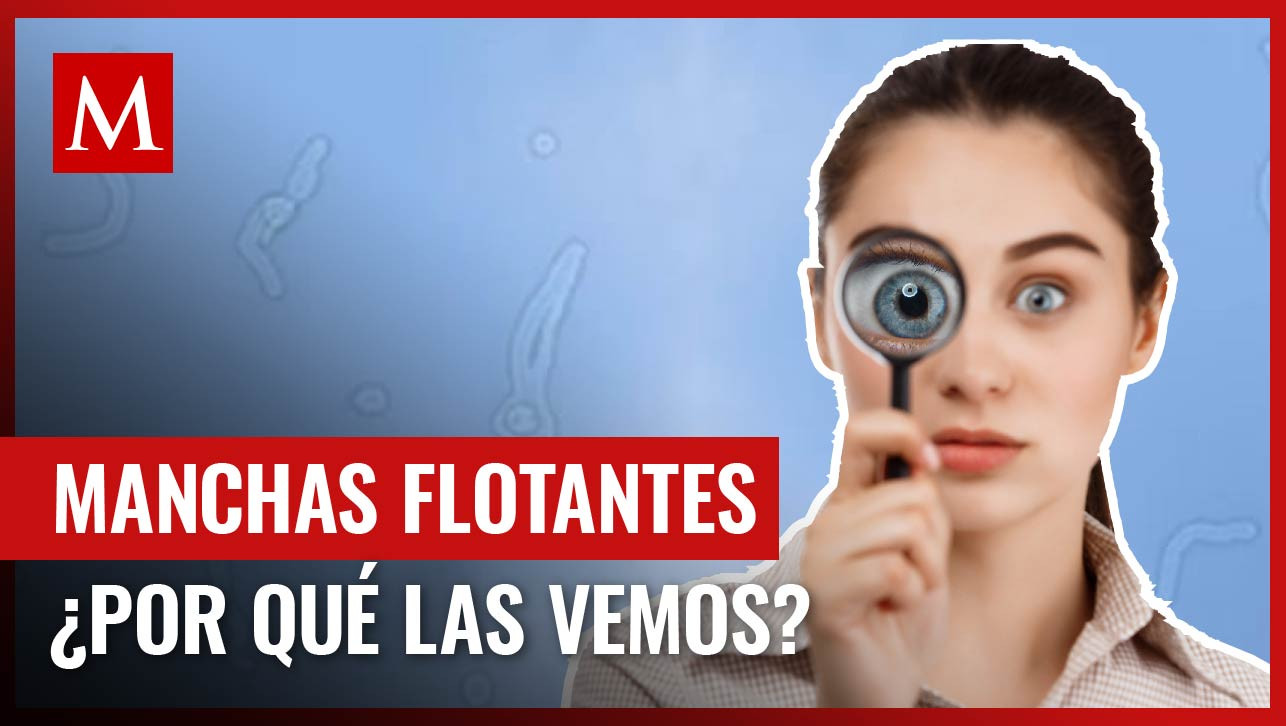 ¿Qué son las manchas flotantes? Te contamos si son graves y si debes buscar ayuda de un oftalmólogo