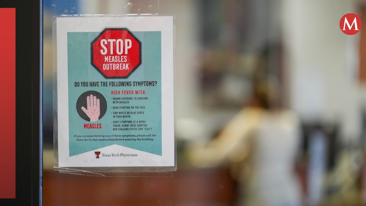 Texas vive su peor brote de sarampión en 30 años. | AP