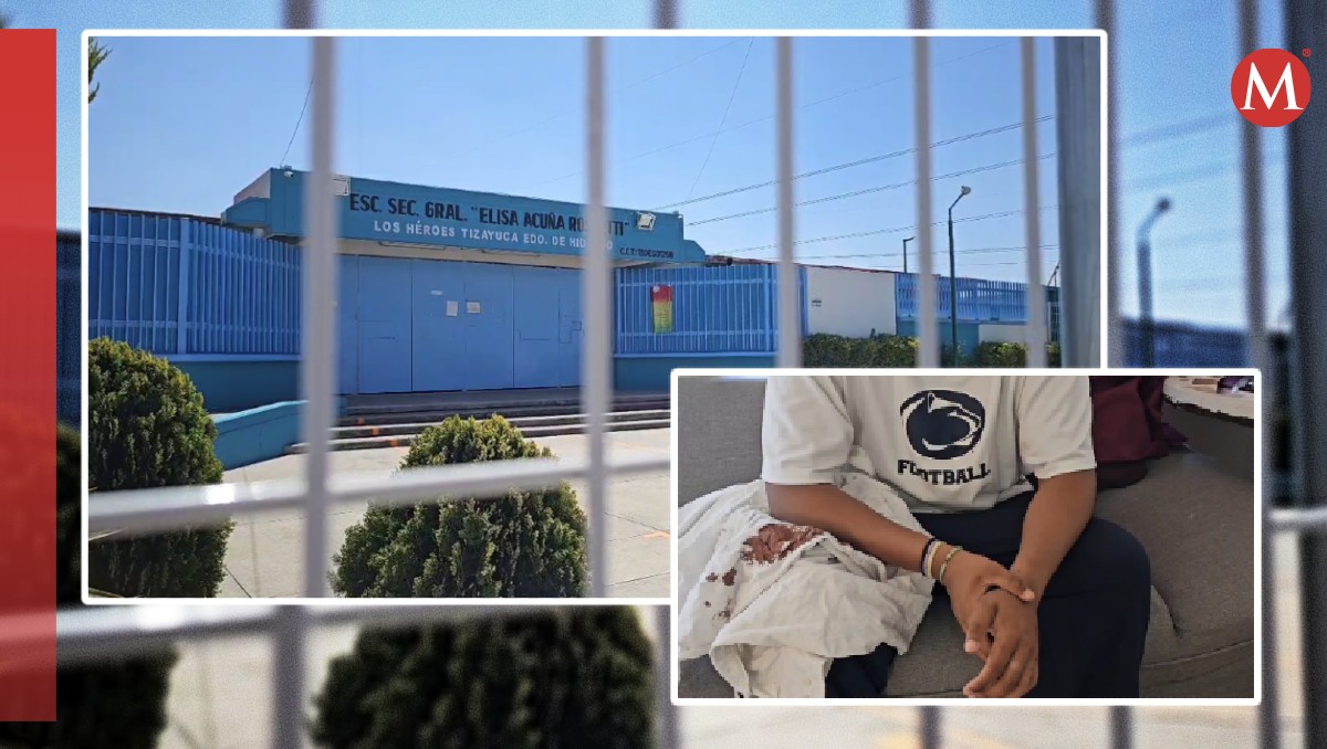 El alumno fue trasladado a la clínica 33 del IMSS para recibir atención | Andrés Lobato