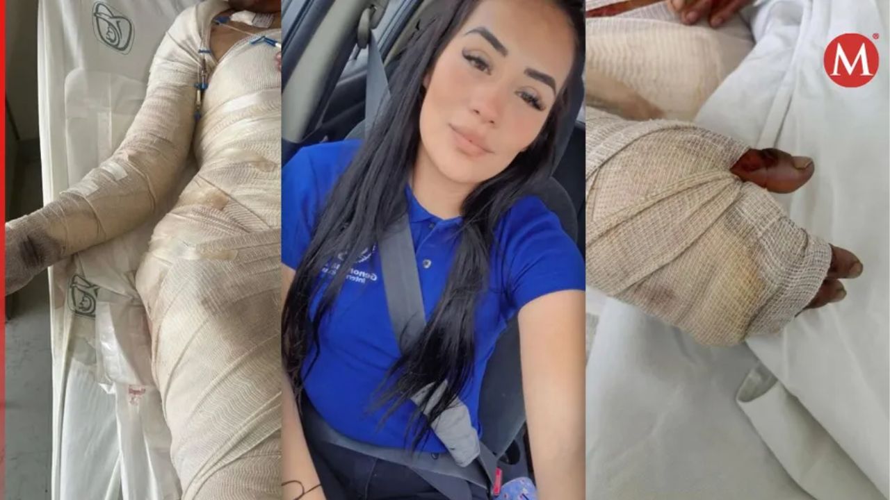 Intentan asesinar a mujer y le prenden fuego en Ciudad Juárez, Chihuahua; agresor sigue prófugo