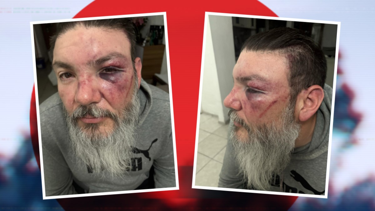 Golpean y roban a aficionados de Pumas al salir del Estadio Cuauhtémoc | Especial