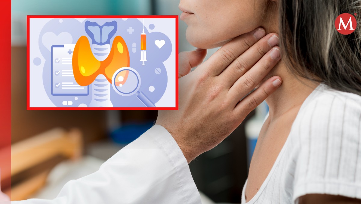 La tiroiditis de Hashimoto también es conocida como tiroiditis linfocítica crónica | Especial