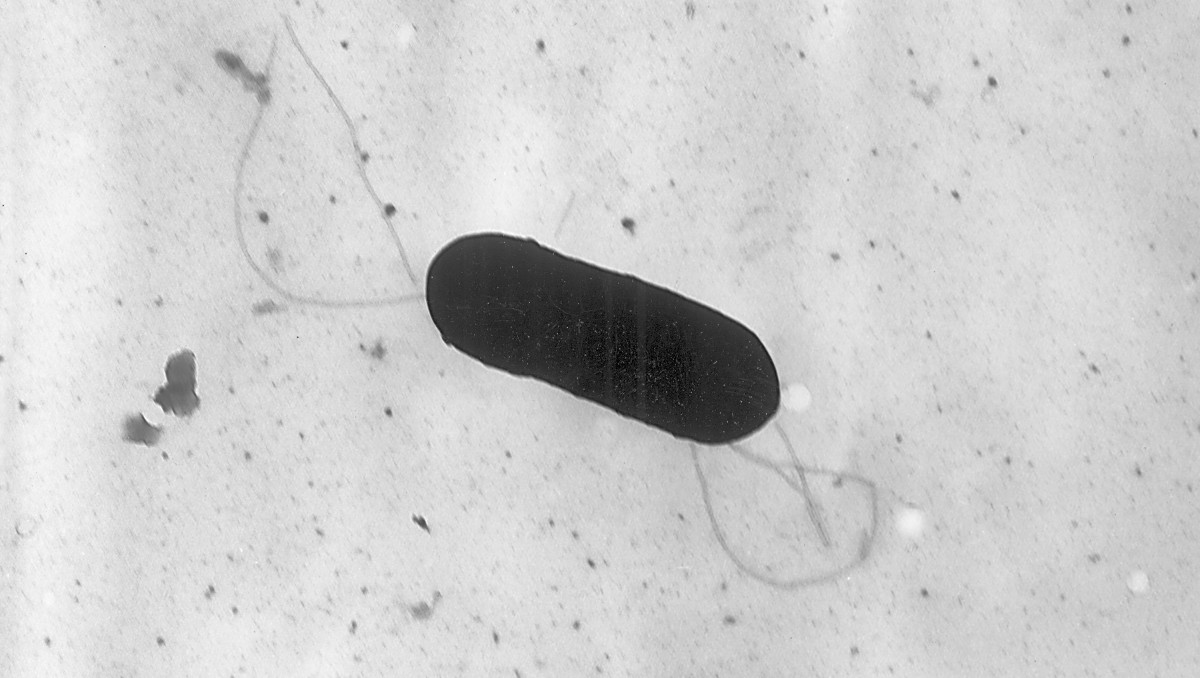 Bacteria Listeria monocytogenes. (Foto: AP)