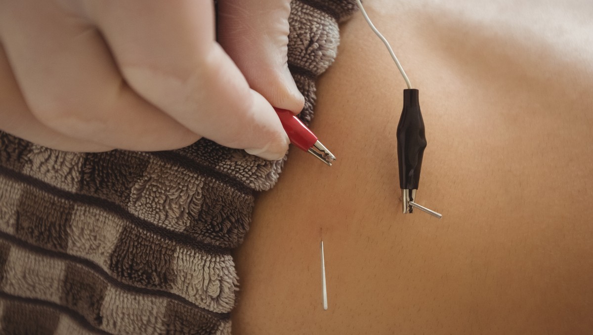 La técnica de electroacupuntura puede ayudarte a a aliviar el dolor de rodilla y otras molestias musculares | Especial