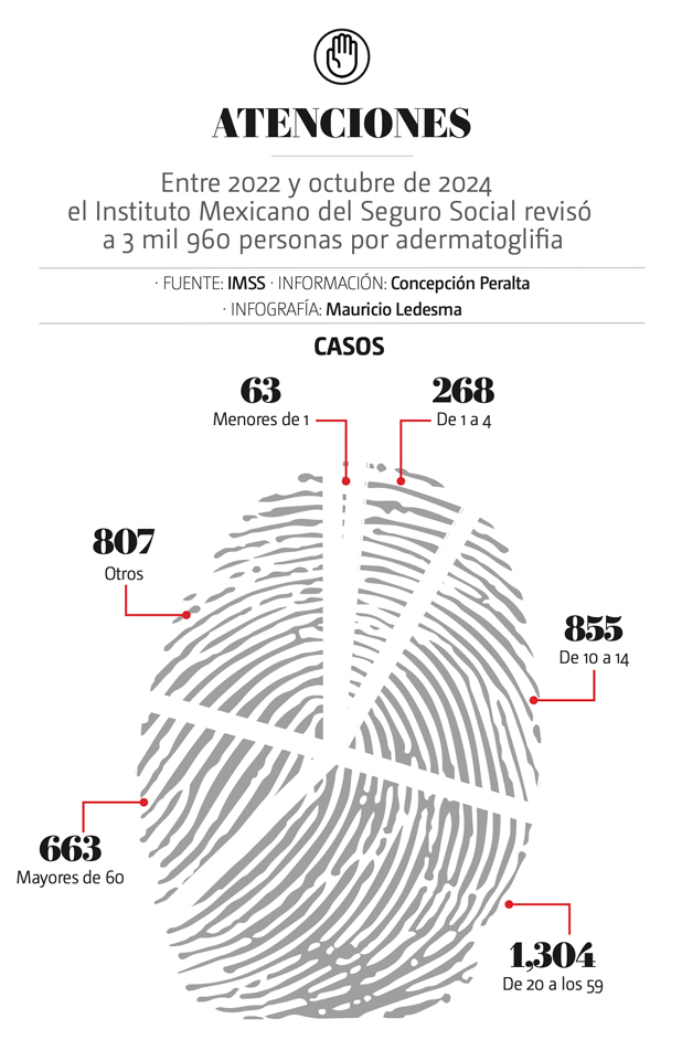 Atenciones: Entre 2022 y octubre de 2024 el Instituto Mexicano del Seguro Social revisóa 3 mil 960 personas por adermatoglifia