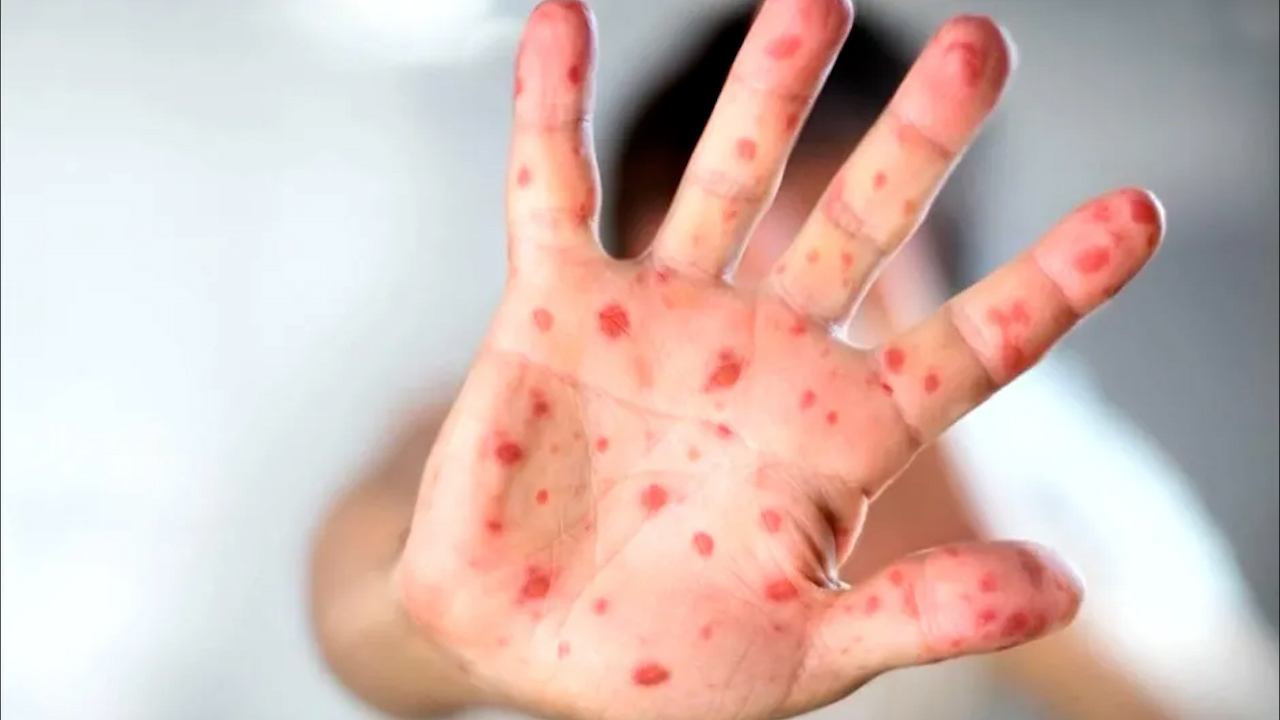 "Vamos a cuidarlos hasta que el último caso sea descartado", afirma secretario de Salud de Sonora