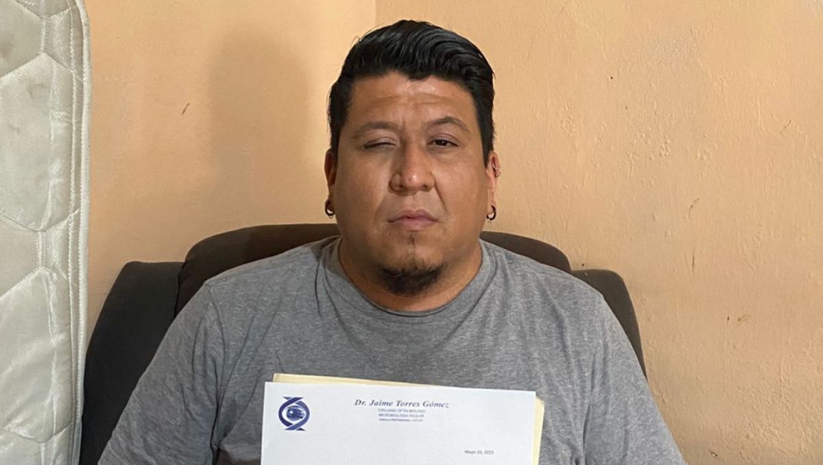 Desde los 18 años la pupila del ojo izquierdo cambió a color blanco. | Lizeth Medrano.