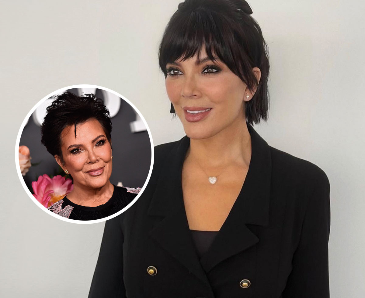 Kris Jenner es una de las celebridades que ha recurrido a tratamientos para rejuvenecer.